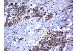 Image no. 4 for anti-Mdm2, p53 E3 Ubiquitin Protein Ligase Homolog (Mouse) (MDM2) (AA 119-438) antibody (ABIN1490872) (MDM2 antibody  (AA 119-438))