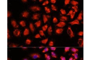 Immunofluorescence analysis of HeLa cells using ADAM8 Polyclonal Antibody at dilution of 1:100 (40x lens).