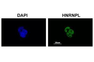 Immunofluorescent staining of MCF-7 cell with HNRNPL polyclonal antibody  at 1:200 dilution.