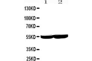Western Blotting (WB) image for anti-Cytochrome P450, Family 2, Subfamily E, Polypeptide 1 (CYP2E1) (AA 1-310) antibody (ABIN3043821)