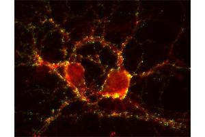 Immunocytochemistry (ICC) image for anti-SynCAM 1/2/3 (AA 436-446) antibody (ABIN1742491) (SynCAM 1/2/3 (AA 436-446) antibody)