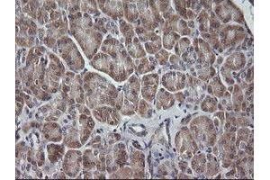 Image no. 1 for anti-Mitogen-Activated Protein Kinase Kinase 3 (MAP2K3) antibody (ABIN1499403) (MAP2K3 antibody)