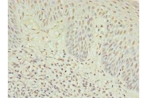 Immunohistochemistry of paraffin-embedded human tonsil tissue using ABIN7174944 at dilution of 1:100 (Myosin IC antibody  (AA 804-1063))