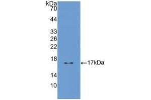 Detection of Recombinant PTN, Human using Polyclonal Antibody to Pleiotrophin (PTN) (Pleiotrophin antibody  (AA 33-168))