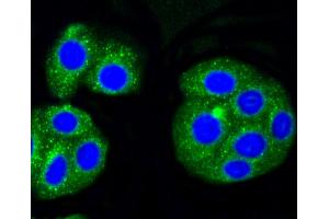 HepG2 cells were stained with Alas1 (1G11) Monoclonal Antibody  at 1:200 in PBS and incubated for overnight at 4C, followed by secondary antibody incubation, DAPI staining of the nuclei and detection (ALAS1 antibody)
