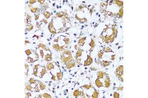 Immunohistochemistry of paraffin-embedded human stomach using I antibody (ABIN7265720) at dilution of 1:100 (40x lens). (ATP5I antibody  (AA 1-69))