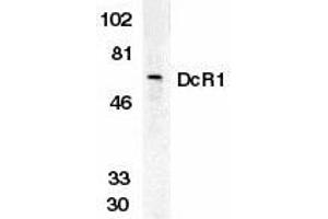 Western blot analysis of DcR1 in HeLa whole cell lysate with DcR1 antibody at 1 g/ml.
