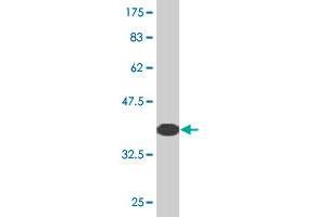 Western Blot detection against Immunogen (36. (Kelch-like protein 41 (KLHL41) (AA 205-304) antibody)
