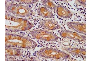 IHC image of ABIN7151786 diluted at 1:400 and staining in paraffin-embedded human small intestine tissue performed on a Leica BondTM system. (EDC4 antibody  (AA 753-952))