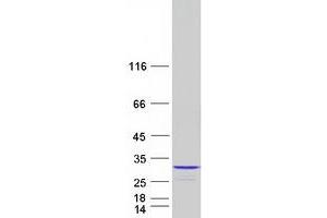 Western Blotting (WB) image for Nudix (Nucleoside Diphosphate Linked Moiety X)-Type Motif 4 (NUDT4) (Transcript Variant 1) protein (Myc-DYKDDDDK Tag) (ABIN2727761)