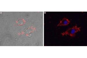 Expression of CaVγ5 (CACNG5) in living rat PC12 cells - Cell surface detection of CaVγ5 (CACNG5) in intact living rat PC12 cells using Anti-CACNG5 (extracellular) Antibody (ABIN7042993, ABIN7044061 and ABIN7044062), (1:25) followed by goat anti-rabbit-AlexaFluor-594 secondary antibody. (CACNG5 antibody  (Extracellular))