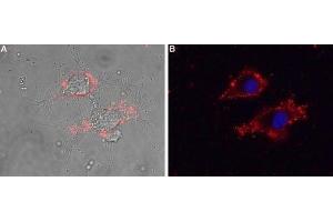 Expression of CaVγ5 (CACNG5) in living rat PC12 cells - Cell surface detection of CaVγ5 (CACNG5) in intact living rat PC12 cells using Anti-CACNG5 (extracellular) Antibody (ABIN7042993, ABIN7044061 and ABIN7044062), (1:25) followed by goat anti-rabbit-AlexaFluor-594 secondary antibody. (CACNG5 antibody  (1st Extracellular Loop))