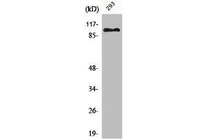 Western Blot analysis of 293 cells using ERCC4 Polyclonal Antibody (ERCC4 antibody  (C-Term))