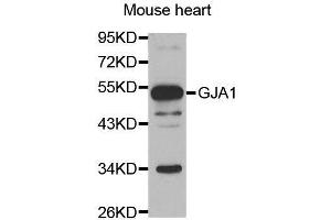 Western blot analysis of extracts of mouse heart, using GJA1 antibody. (Connexin 43/GJA1 antibody  (AA 233-382))