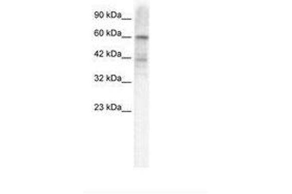 KCND3 antibody  (AA 424-473)