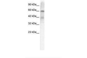 Image no. 1 for anti-Potassium Voltage-Gated Channel, Shal-Related Subfamily, Member 3 (KCND3) (AA 424-473) antibody (ABIN202843) (KCND3 antibody  (AA 424-473))
