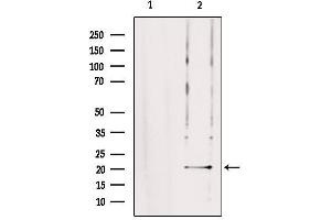 Western blot analysis of extracts from rat brain, using TRAPPC5 Antibody. (TRAPPC5 antibody  (Internal Region))