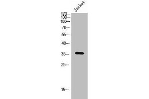 OR6Q1 antibody  (Internal Region)