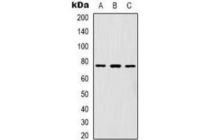 Western blot analysis of FOXK1 expression in Hela (A), A431 (B), Jurkat (C) whole cell lysates. (Foxk1 antibody  (C-Term))