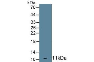 Detection of Recombinant OAS1, Human using Monoclonal Antibody to 2',5'-Oligoadenylate Synthetase 1 (OAS1) (OAS1 antibody  (AA 74-165))