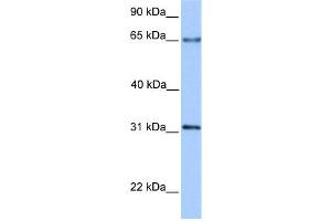 WB Suggested Anti-ZNF394 Antibody Titration:  0. (ZNF394 antibody  (N-Term))