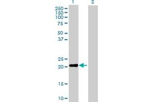 Western Blot analysis of MS4A4A expression in transfected 293T cell line by MS4A4A MaxPab polyclonal antibody.