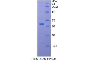 SDS-PAGE analysis of Human Protease, Serine 8 Protein. (Protease Protein)
