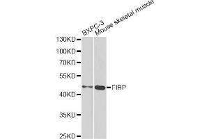 Western blot analysis of extracts of various cell lines, using FIBP antibody.