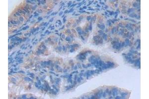 Detection of MYLK2 in Mouse Oviduct Tissue using Polyclonal Antibody to Myosin Light Chain Kinase 2 (MYLK2) (MYLK2 antibody  (AA 330-548))