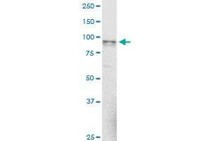 NAGLU monoclonal antibody (M02), clone 1B7. (NAGLU antibody  (AA 644-742))