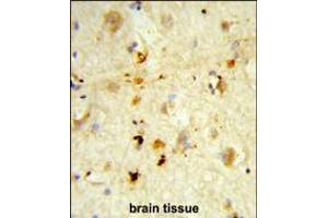 Formalin-fixed and paraffin-embedded human brain tissue reacted with ITGBL1 Antibody , which was peroxidase-conjugated to the secondary antibody, followed by DAB staining.