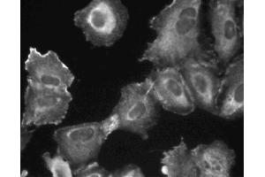 Immunofluorescent staining of A549 (ATCC CCL-185) cells. (PIK3C2B antibody  (AA 16-209))