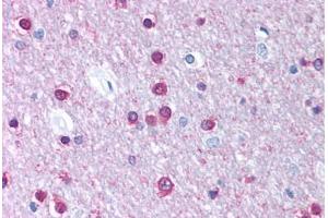 Human Brain, Cortex, White Matter (formalin-fixed, paraffin-embedded) stained with CACNB1 antibody ABIN214731 at 5 ug/ml followed by biotinylated goat anti-rabbit IgG secondary antibody ABIN481713, alkaline phosphatase-streptavidin and chromogen. (CACNB1 antibody  (AA 21-70))