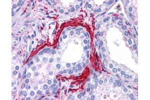ATG5 antibody was used for immunohistochemistry at a concentration of 4-8 ug/ml. (ATG5 antibody)