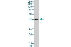 GOT2 polyclonal antibody (A01), Lot # FHC0061120QCS1. (GOT2 antibody  (AA 331-430))
