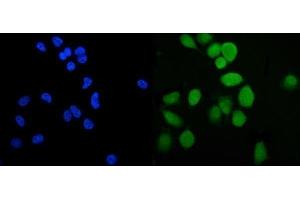 IF analysis of PLTP using anti-PLTP antibody (ABIN7600346). (PLTP antibody  (AA 18-470))