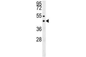 SUV39H1 western blot analysis in MDA-MB435 lysate. (SUV39H1 antibody  (N-Term))