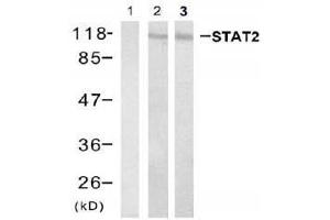 Western blot analysis of extracts from Hela cell and HL60 cell using stat2 (Ab-690) Antibody (E021536, Lane 1, 2 and 3 )