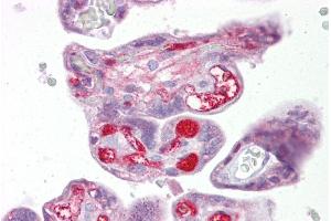 Immunohistochemistry with Placenta tissue at an antibody concentration of 5µg/ml using anti-SLC26A4 antibody (ARP41739_P050) (SLC26A4 antibody  (Middle Region))
