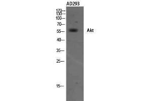 Western Blotting (WB) image for anti-V-Akt Murine Thymoma Viral Oncogene Homolog 1 (AKT1) (Internal Region) antibody (ABIN3173747) (AKT1 antibody  (Internal Region))