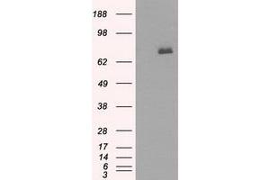 HEK293T cells were transfected with the pCMV6-ENTRY control (Left lane) or pCMV6-ENTRY BTK (Right lane) cDNA for 48 hrs and lysed. (BTK antibody)