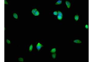 Immunofluorescence staining of MCF-7 cells with ABIN7160220 at 1:400, counter-stained with DAPI. (SMAD1 antibody  (AA 150-250))