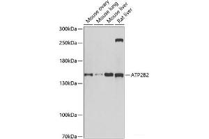 Western blot analysis of extracts of various cell lines using ATP2B2 Polyclonal Antibody at dilution of 1:1000.