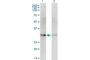 Western Blot analysis of CDK4 expression in transfected 293T cell line by CDK4 monoclonal antibody (M10), clone 1E1. (CDK4 antibody  (AA 1-303))