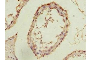 Immunohistochemistry of paraffin-embedded human testis tissue using ABIN7143006 at dilution of 1:100 (FIBP antibody  (AA 1-364))