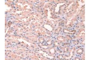Immunohistochemistry (IHC) image for anti-Fibronectin (AA 313-607) antibody (ABIN1077665)