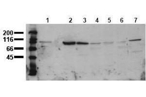 Western Blotting (WB) image for anti-Catenin (Cadherin-Associated Protein), beta 1, 88kDa (CTNNB1) (AA 35-50) antibody (ABIN126744) (CTNNB1 antibody  (AA 35-50))