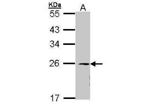 WB Image Sample (30 ug of whole cell lysate) A: 293T 12% SDS PAGE antibody diluted at 1:1000 (EIF3K antibody)