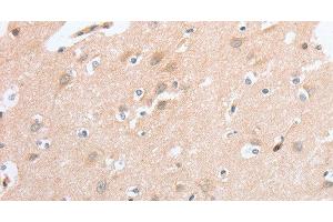 Immunohistochemistry of paraffin-embedded Human brain tissue using SIGLEC9 Polyclonal Antibody at dilution 1:40 (SIGLEC9 antibody)