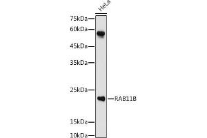 Western blot analysis of extracts of HeLa cells, using RB antibody (ABIN7269795) at 1:1000 dilution. (RAB11B antibody  (AA 130-215))